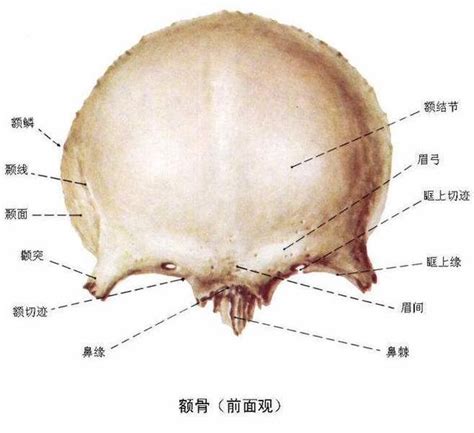 額骨凹陷